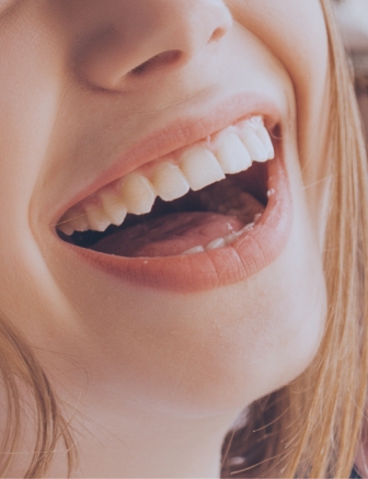 Close-up of woman showing off her teeth